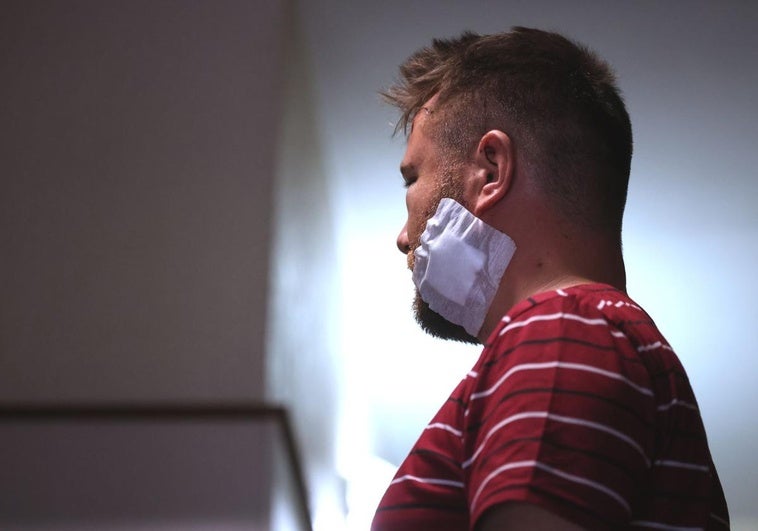 La víctima, que prefiere mantenerse en el anonimato, con la herida entre la mandíbula y el cuello que le causaron los agresores.