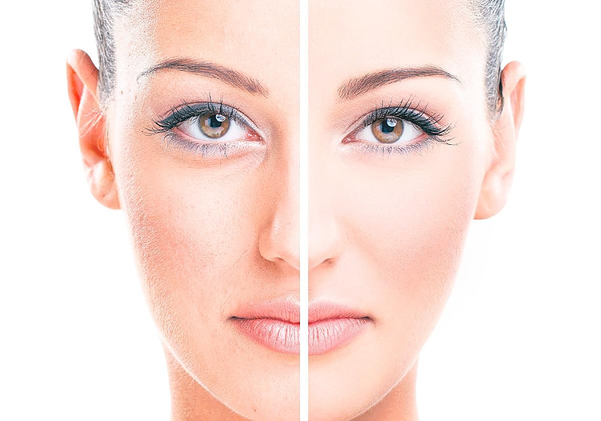 El paciente busca tratamientos no invasivos, sin tiempo de inactividad, cómodos y con resultados