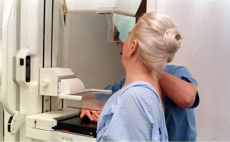 Una mujer se realiza una mamografía en un centro sanitario.