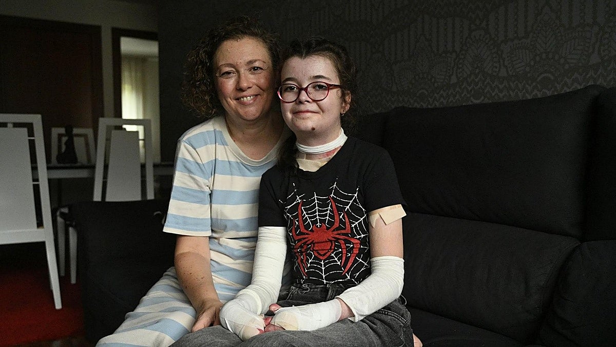 «No le están poniendo precio a un fármaco, sino al dolor de mi hija»: la lucha de Saioa por la terapia génica contra la piel de mariposa