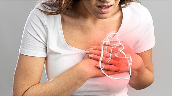 «Los síntomas menos conocidos del infarto en mujeres pueden retrasar el diagnóstico»