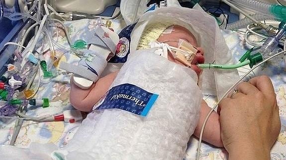 Unos médicos británicos congelan a un recién nacido para salvarle la vida
