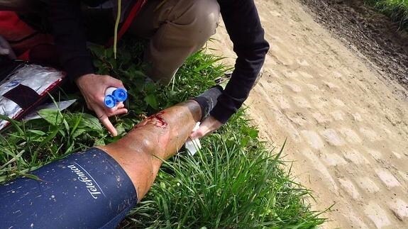 Así quedó la pierna de Fran Ventoso en la París Roubaix 