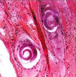 Larvas de triquinosis vistas en microscopio.