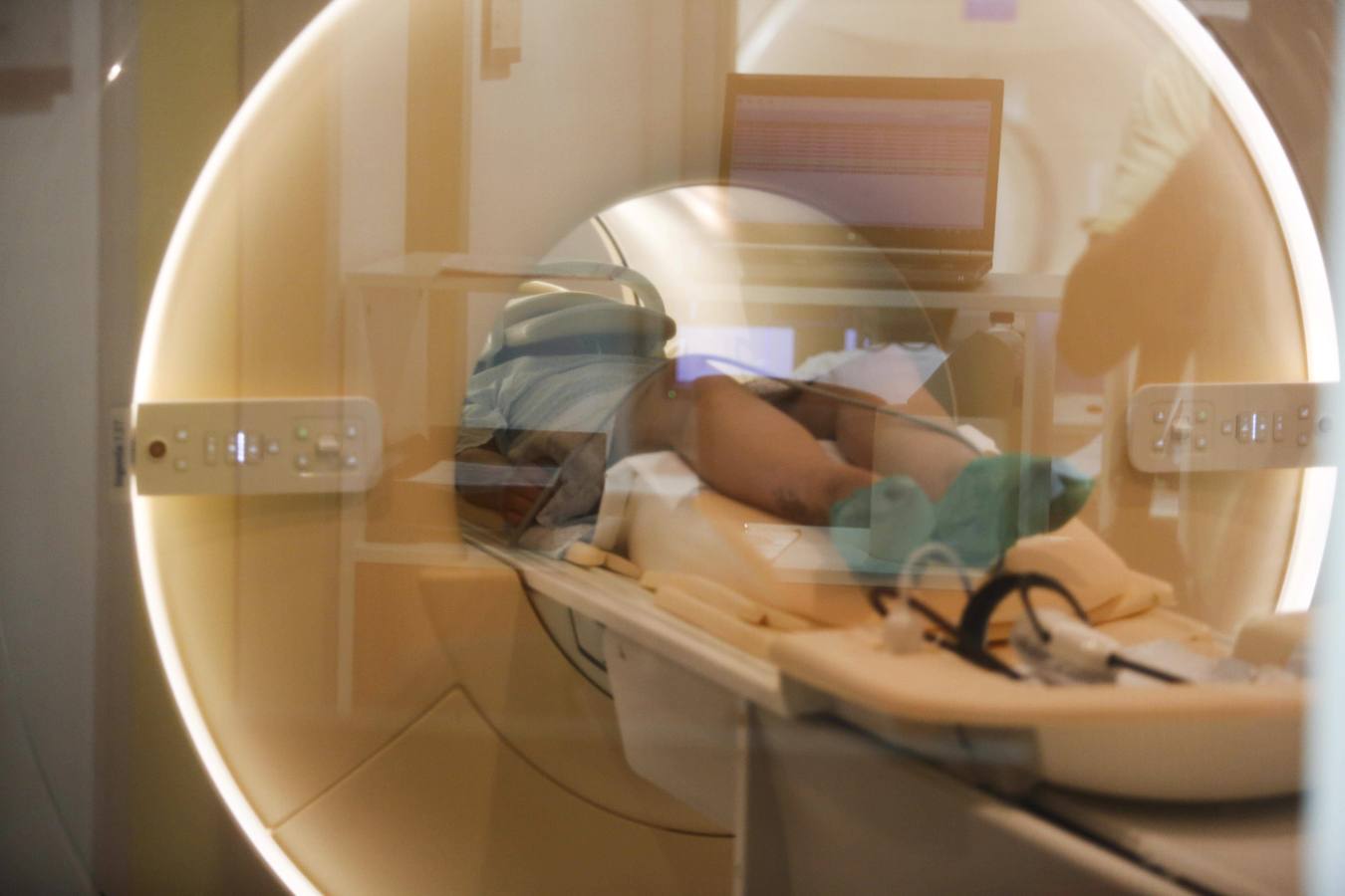 El Álvarez Buylla, puntero en radiología