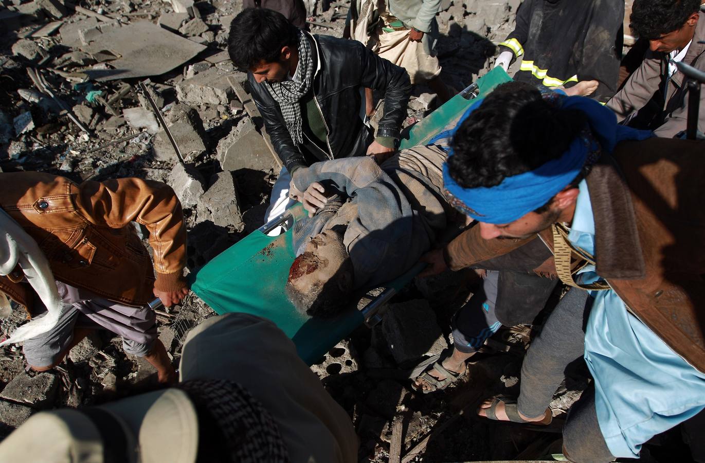 Baño de sangre en Yemen