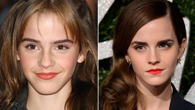 Emma Watson.