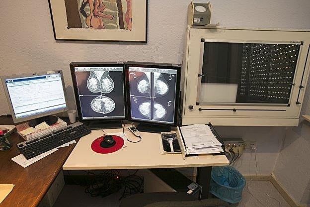 El resultado de unas mamografía, visto en una sala de radiología. 