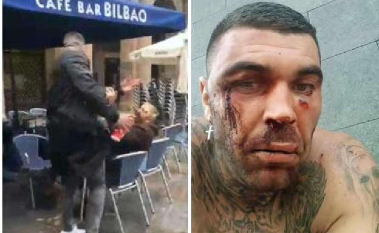 El ultra que agredió al joven de Bilbao tras la paliza que recibió en Tenerife. 