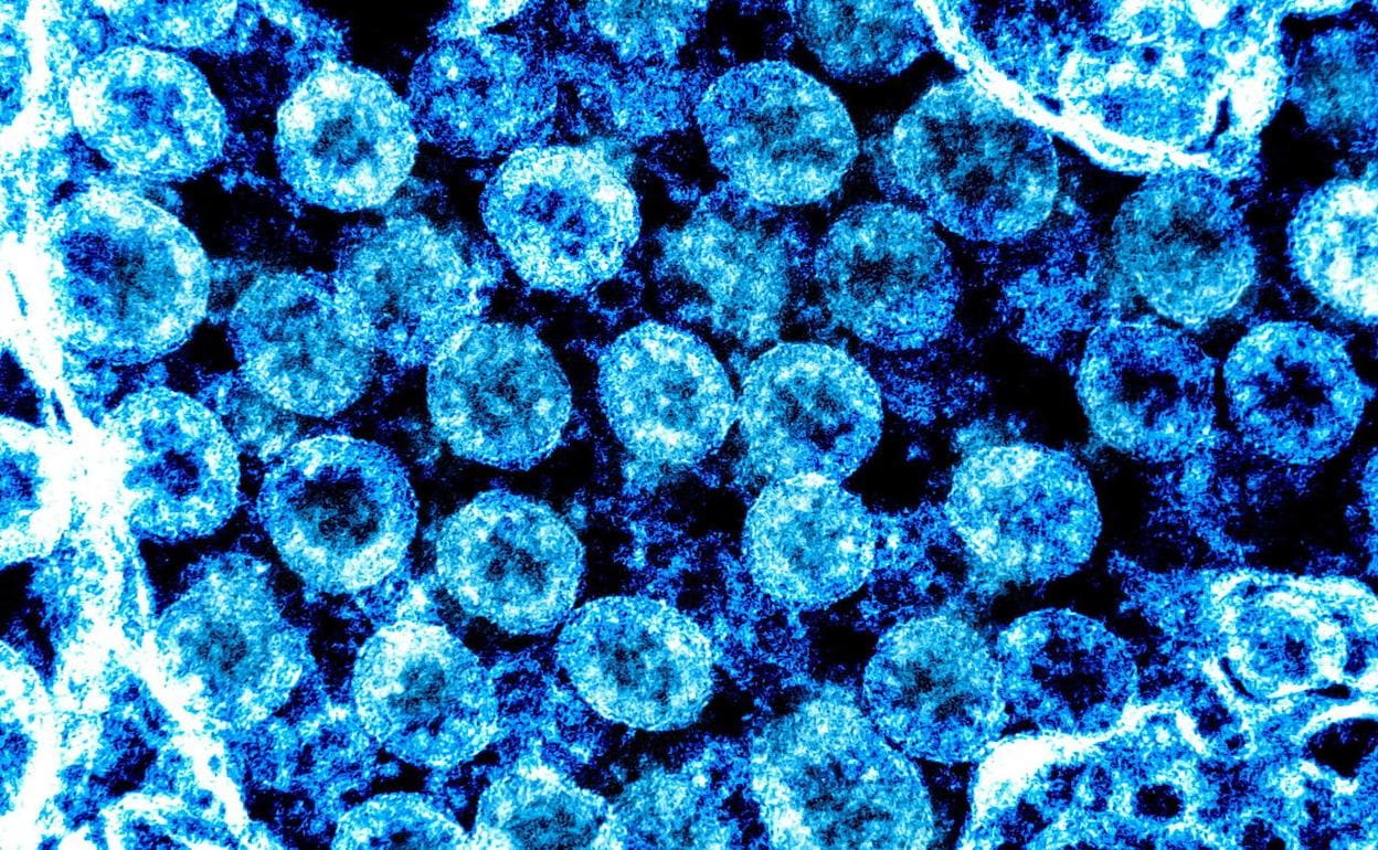 Imagen del coronavirus SARS-CoV-2, causante del COVID-19, tomada con microscopio electrónico