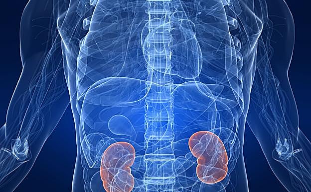El diagnóstico precoz del cáncer de riñón incrementa un 70% las posibilidades de supervivencia