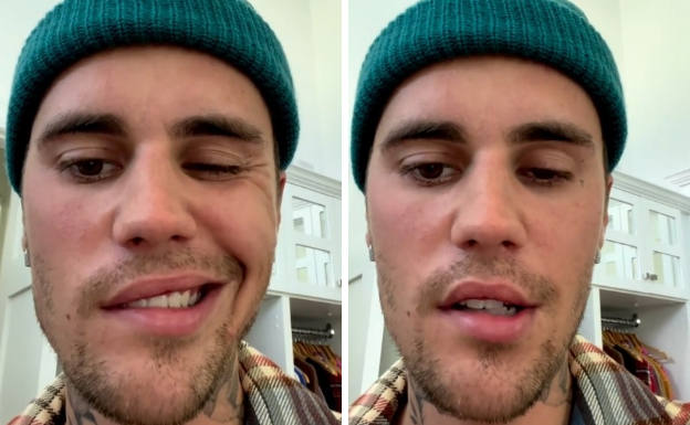 Una parálisis facial obliga a Justin Bieber a cancelar sus próximos conciertos