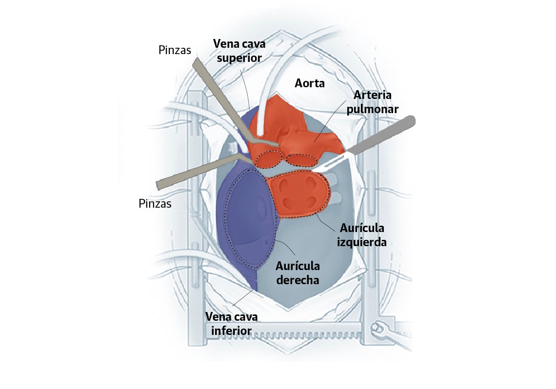 Scroll Story imagen 3