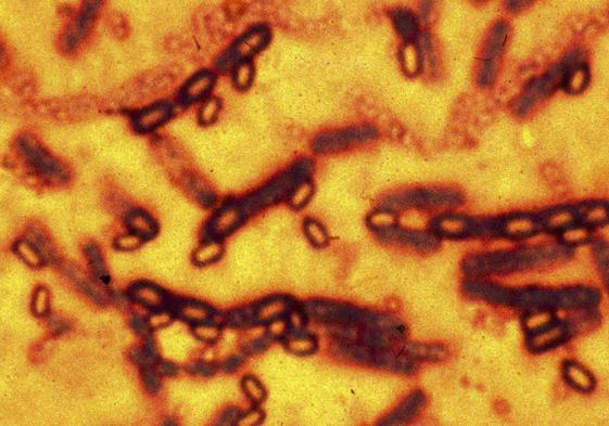 Imagen microscópica de las esporas y células vegetativas de Bacillus anthracis que causa la enfermedad del ántrax.