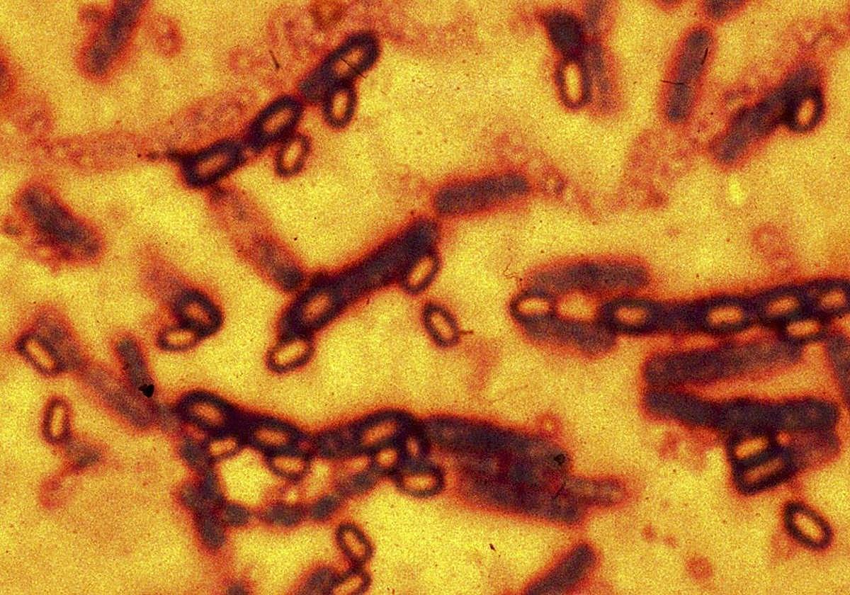 Imagen microscópica de las esporas y células vegetativas de Bacillus anthracis que causa la enfermedad del ántrax.