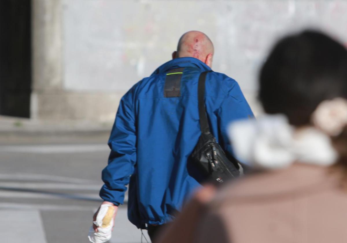 La víctima, ensangrentada, tras ser brutalmente agredido por cuatro individuos.