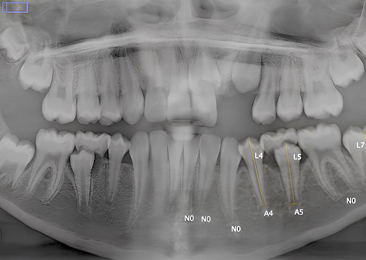 Imagen secundaria 1 - Radiografías de unas manos y una dentadura.