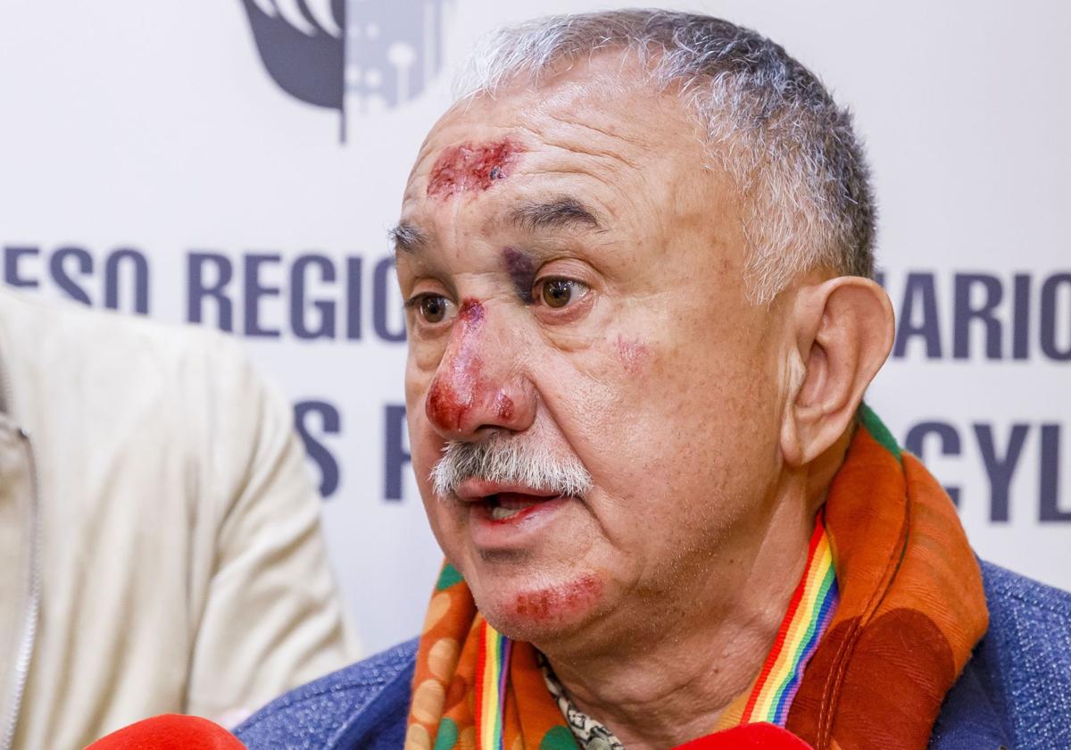Pepe Álvarez, con la cara llena de heridas en su último acto público
