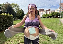 Sonia Chacón muestra sus vendajes en Pola de Siero.