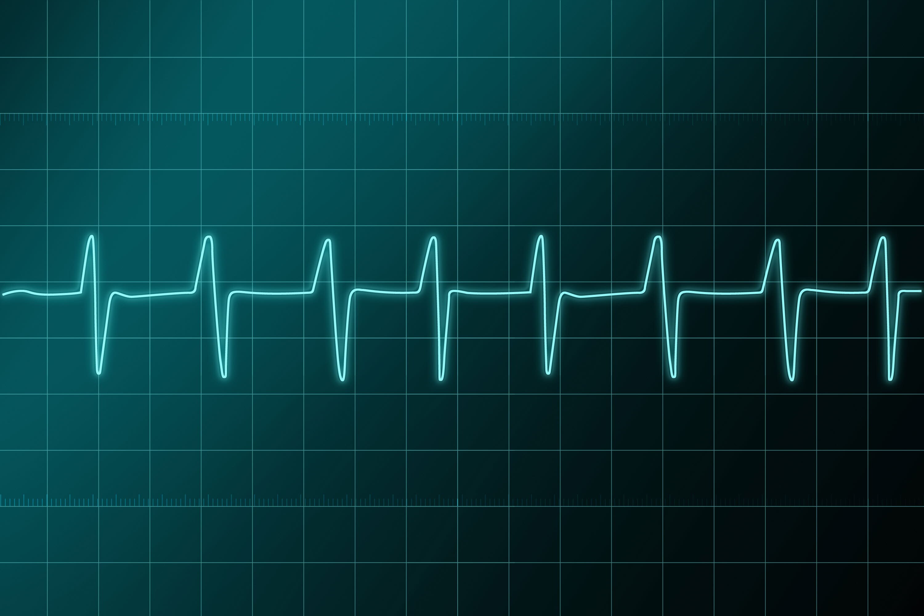 El monitor cardiaco mini e inyectable que detecta las arritmias
