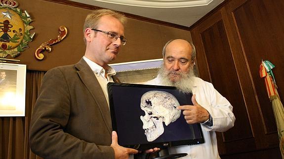 Hallan en una mujer egipcia las evidencias más antiguas de un cáncer de mama