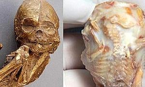 Una anciana da a luz a un bebé fósil 56 años después