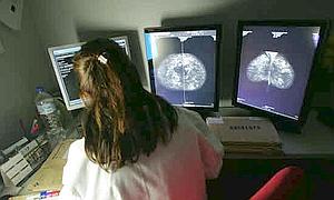 Una médica observa en las pantallas los resultados de una mamografía realizada en el Hospital de Cruz Roja. / CITOULA