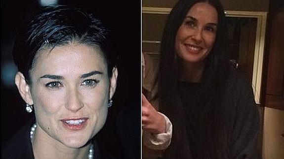 Demi Moore, ¿síndrome de Renne Zellweger?