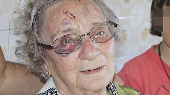 María Iglesias tiene tres heridas en la cabeza, un ojo morado y cardenales por todo el cuerpo a causa de la agresión. 