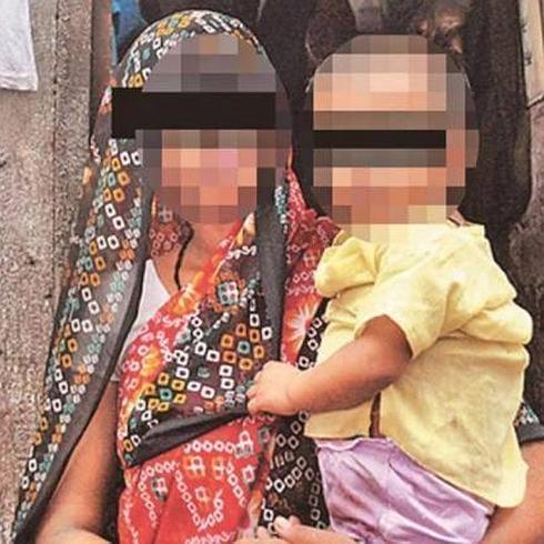 Operan en la India a un niño con tres penes