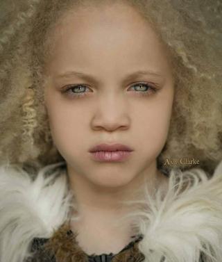Ava Clarke, la niña negra albina que encandila a los internautas | El  Comercio