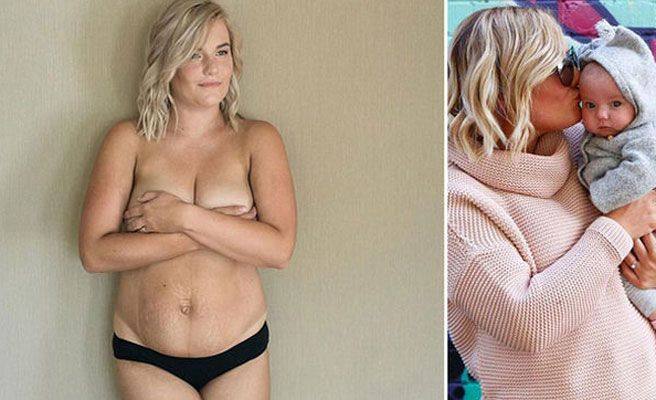 Una bloguera se desnuda para mostrar el cuerpo real tras el parto
