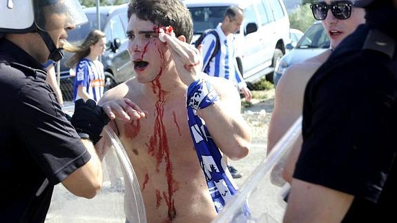 Un seguidor albiazul sangra de la cabeza tras el ataque de los ultras del Jaén. 