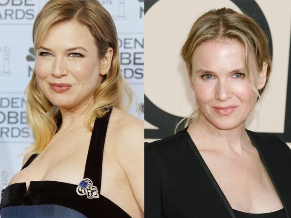 Renée Zellweger.