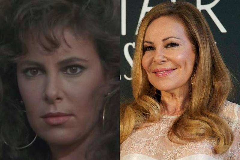 Ana Obregón, antes y después de operarse. 