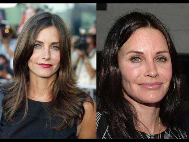 Courtney Cox, antes y después de operarse. 