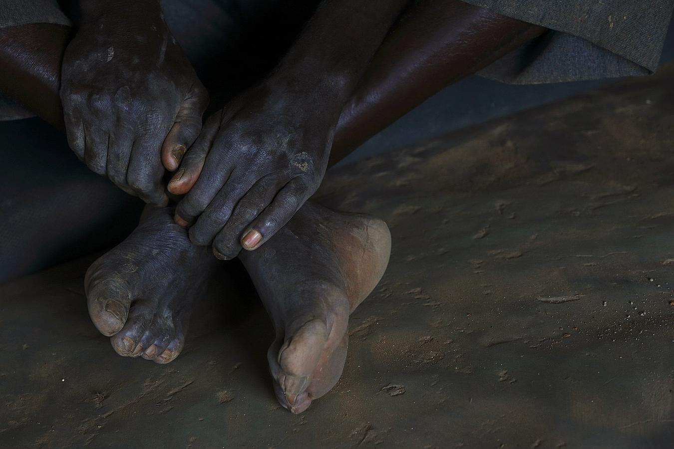 Zambia sobrevive al sida