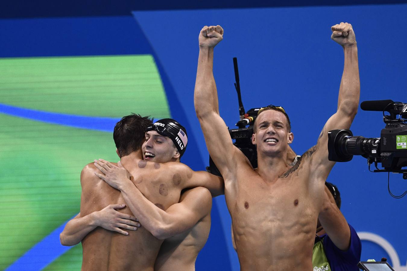 Así son los moratones de Phelps