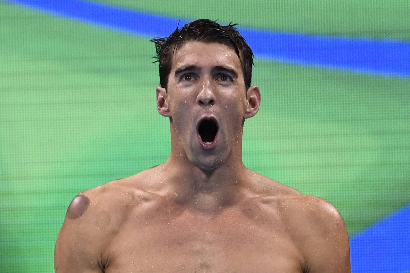 Así son los moratones de Phelps