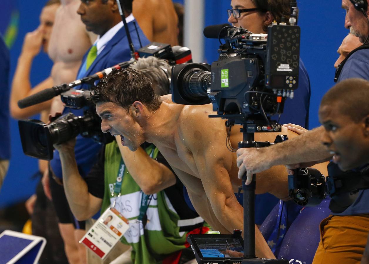 Así son los moratones de Phelps