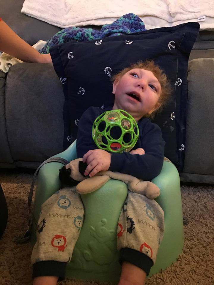 Así vive Jaxon, un niño con microcefalia