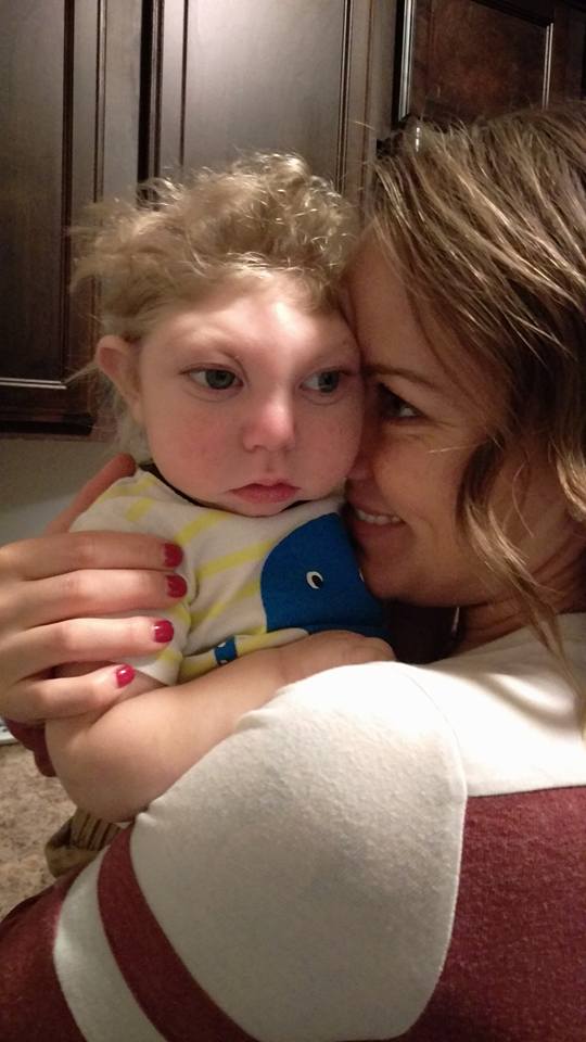 Así vive Jaxon, un niño con microcefalia