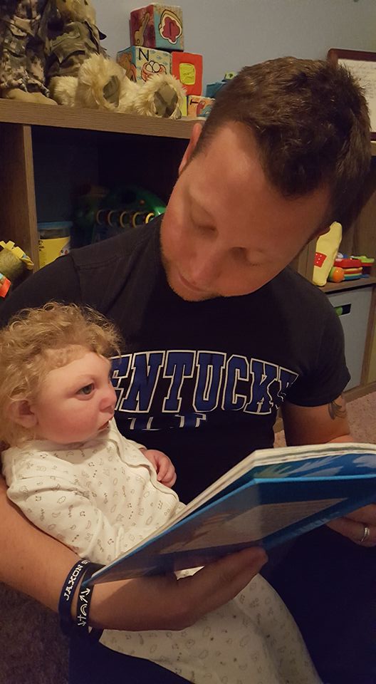 Así vive Jaxon, un niño con microcefalia