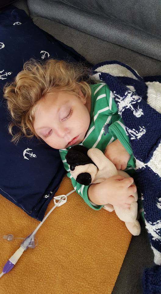 Así vive Jaxon, un niño con microcefalia