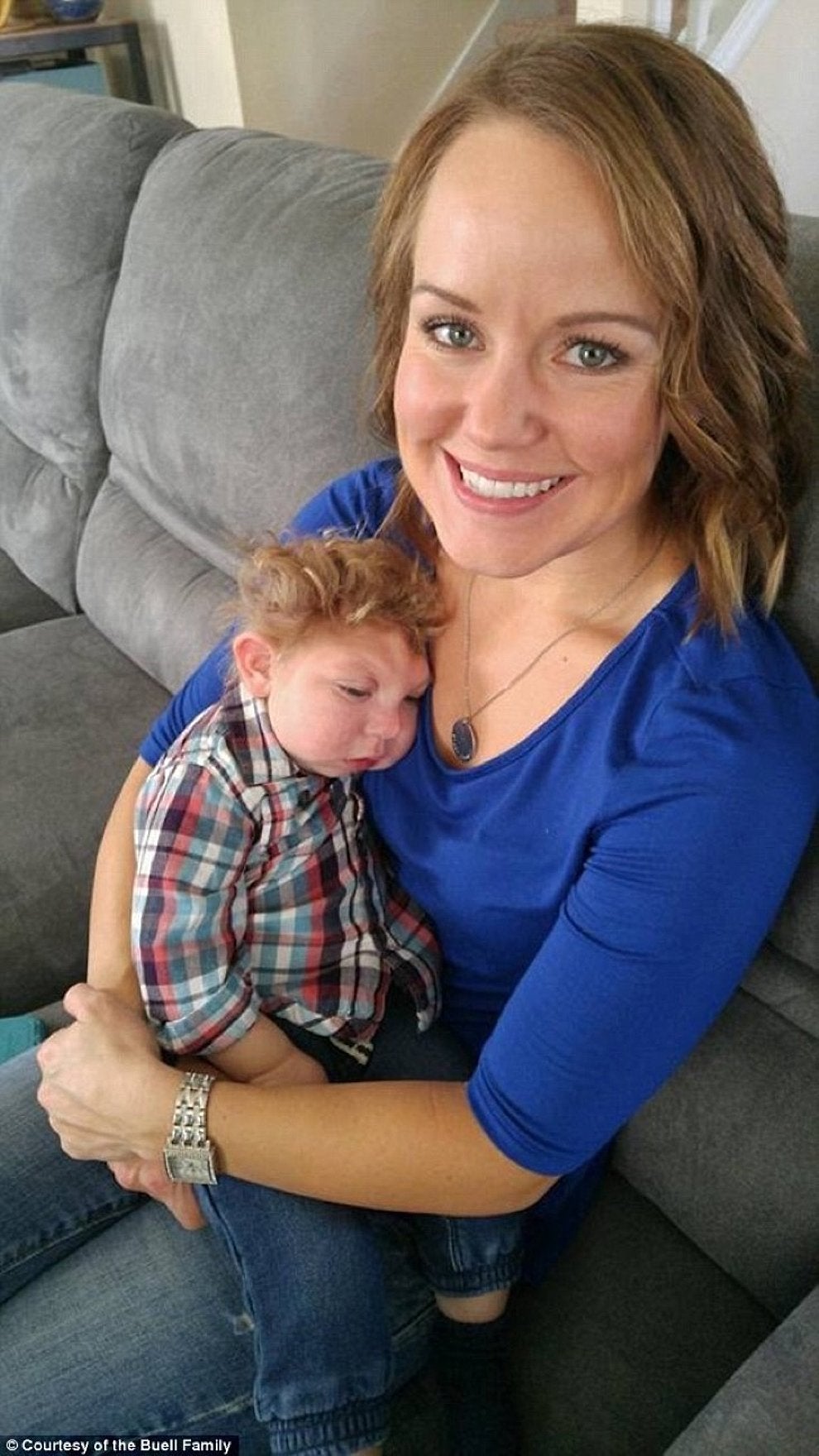 Así vive Jaxon, un niño con microcefalia