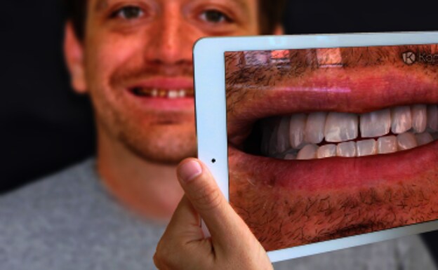 El software acelera el proceso de cambio dental.