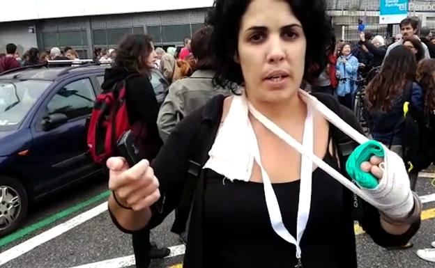 La mujer que aseguró que le habían roto los dedos de una mano en el referéndum dice ahora que sufre una inflamación