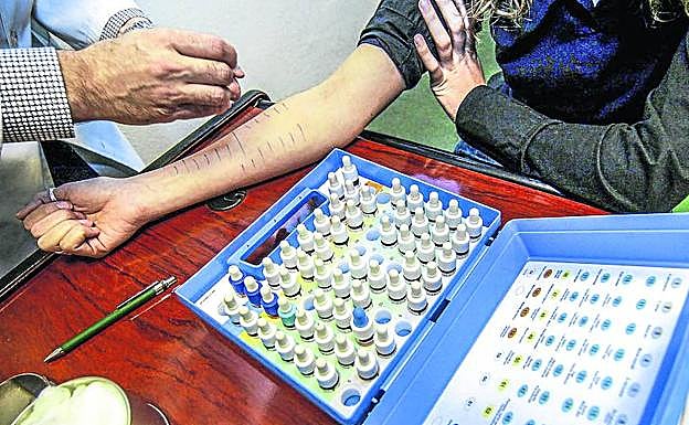 Las pruebas para la detección de alergias alimentarias se realizan sobre la piel, como en la imagen, o en sangre.