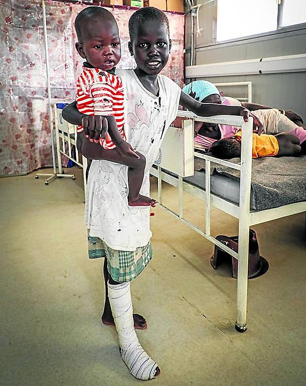 Víctimas. A Aluk Manut, una niña sudanesa de 6 años, le mordió una serpiente cuando jugaba fuera de su casa. Arop Magut, de 49, lleva cinco operaciones en su pie izquierdo por la misma razón.