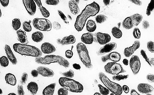 El brote de 'fiebre Q' de La Rioja se salda con nueve vizcaínos afectados